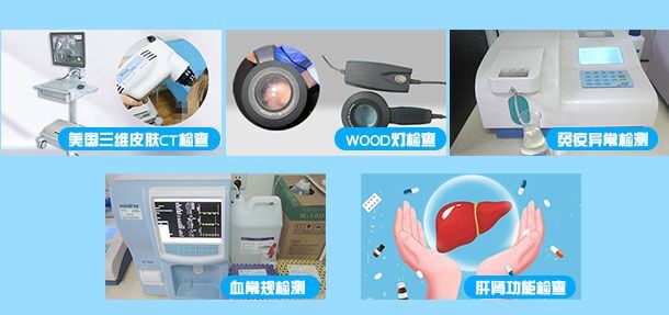 颈部长了白癜风要注意什么